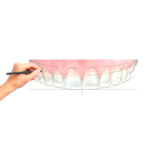 diseño de la nueva sonrisa